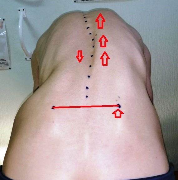Тест Адамса